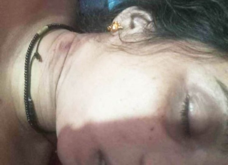 गोल्ड मेडलिस्ट नववधु की मौत, मायके वालों ने लगाया दहेज हत्या का आरोप