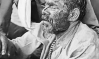 टाइगर के बाद अब भालू के हमले में चरवाहा घायल:जंगल में मवेशी चराने गया था, झपट पड़ा भालू