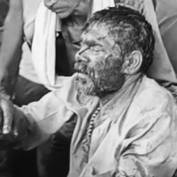 टाइगर के बाद अब भालू के हमले में चरवाहा घायल:जंगल में मवेशी चराने गया था, झपट पड़ा भालू