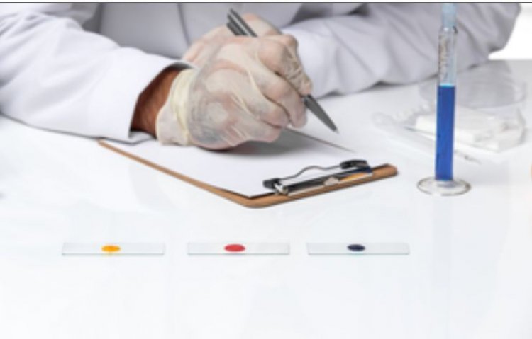 मेडिकल रिपोर्ट देखकर आमतौर पर बढ़ जाती है मरीजों की चिंता, अध्ययन ने बताया कारण