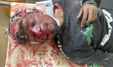 BIG BREAKING JASHPUR: सन्ना थाना क्षेत्र में दर्दनाक सड़क हादसा " अनियंत्रित होकर गिरा युवक ओर फिर.... पढ़िए पूरी खबर