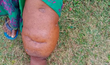 जशपुर:जिले के हर व्यक्ति को फाइलेरिया की दवाई खिलाकर जड़ से किया जाएगा उन्मूलन....