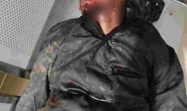 Big Breaking Jashpur: पिकअप और बाइक में जबरदस्त भिड़ंत " एक की मौत दूसरे की स्तिथि गंभीर,अंबिकापुर रेफर" यहां का है मृतक .... जांच में जुटी पुलिस 