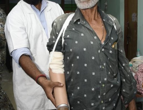 धमतरी के तेजराम को दो घंटे में मिला कृत्रिम हाथ, लौटी जिंदगी की रंगत
