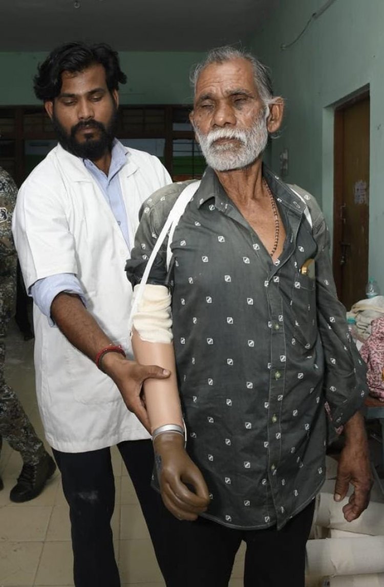 धमतरी के तेजराम को दो घंटे में मिला कृत्रिम हाथ, लौटी जिंदगी की रंगत